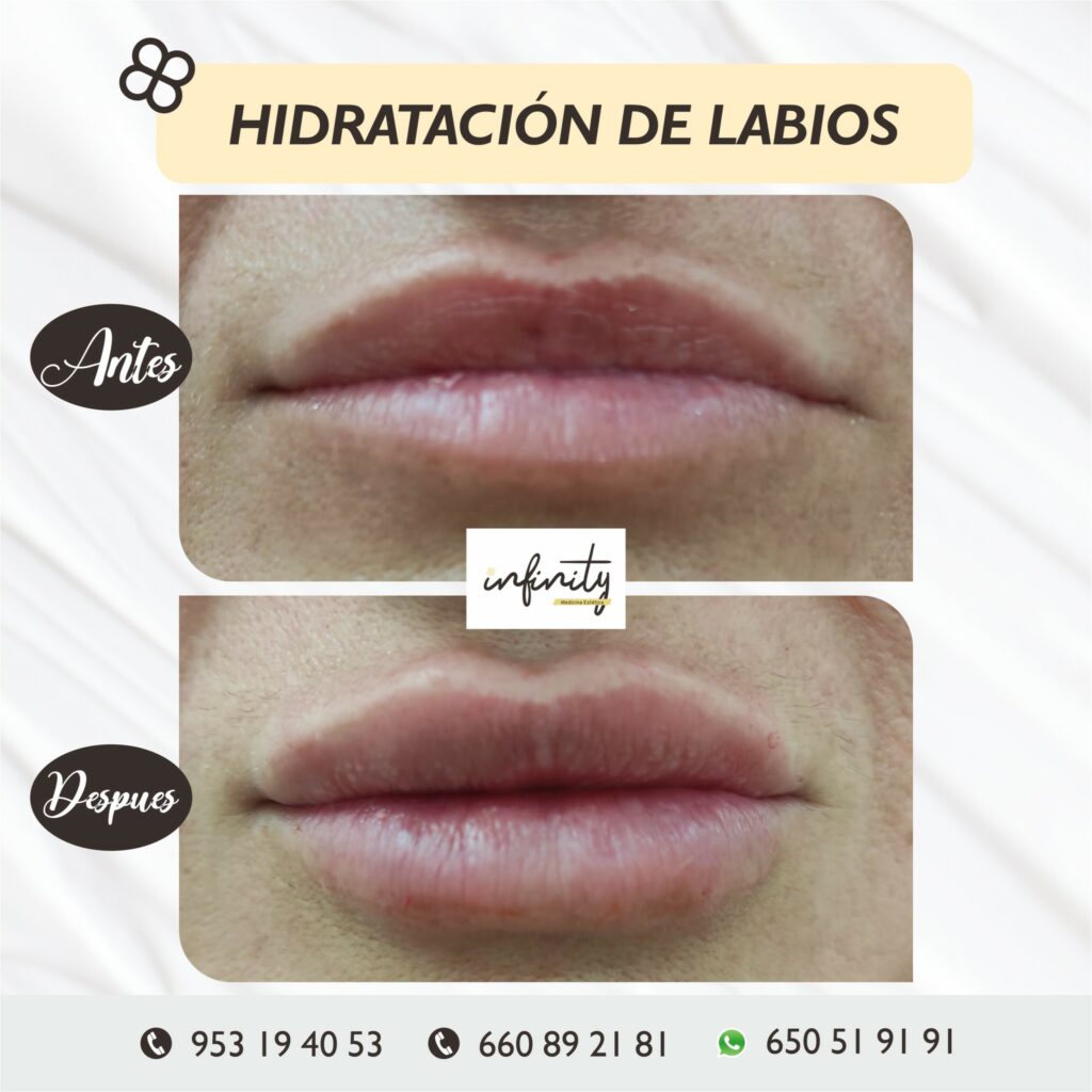 los mejores tratamientos para labios de Jaén